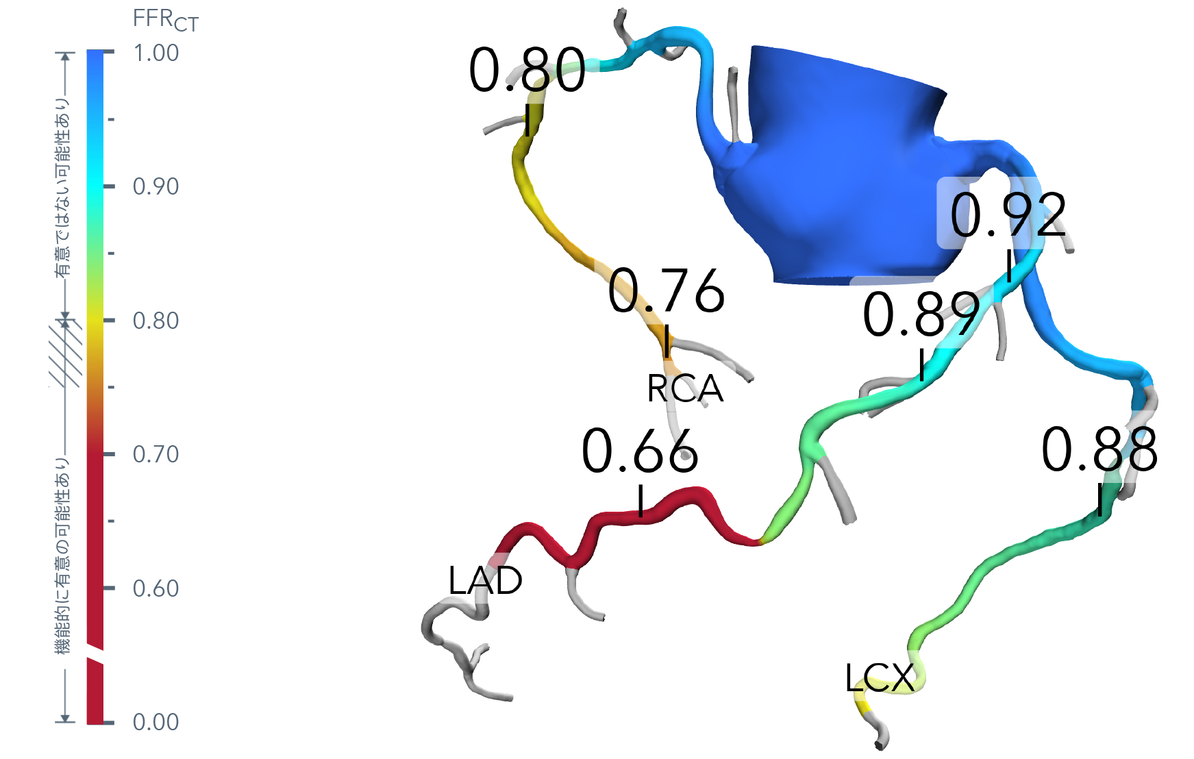FFRCTの画像イメージ