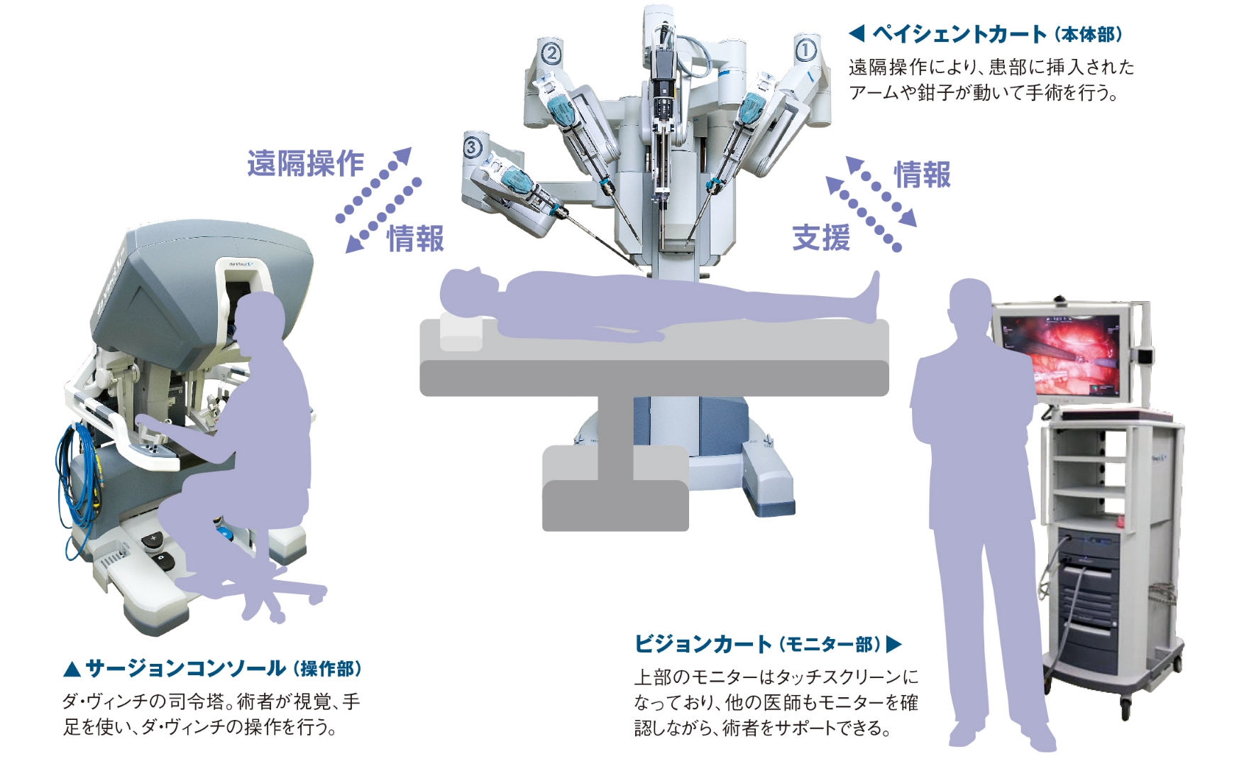 ダ･ヴィンチ手術のイメージ図