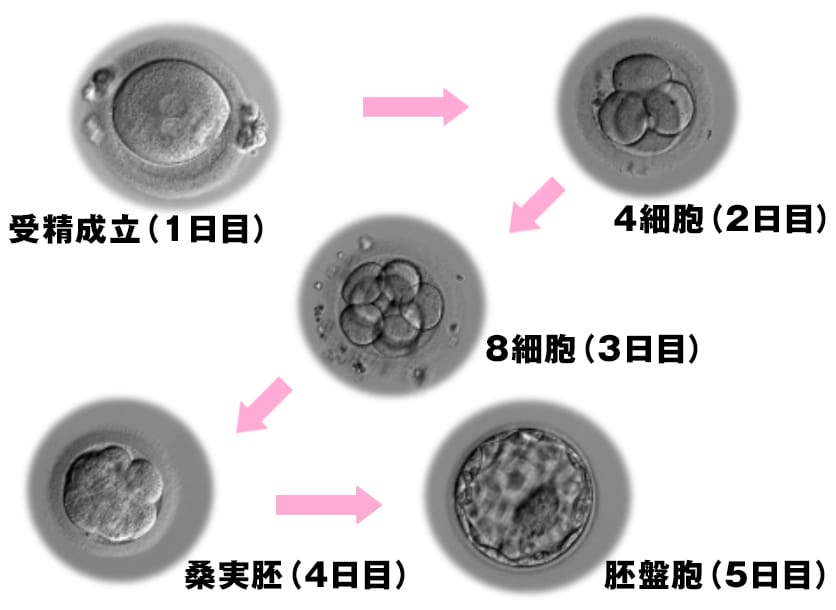 培養の図