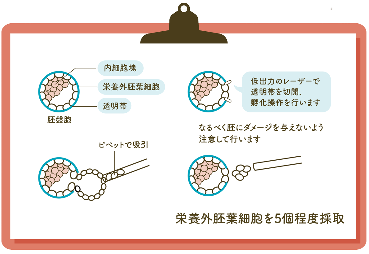 PGT-Aの概要図