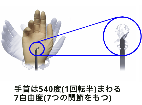 鉗子の動き
