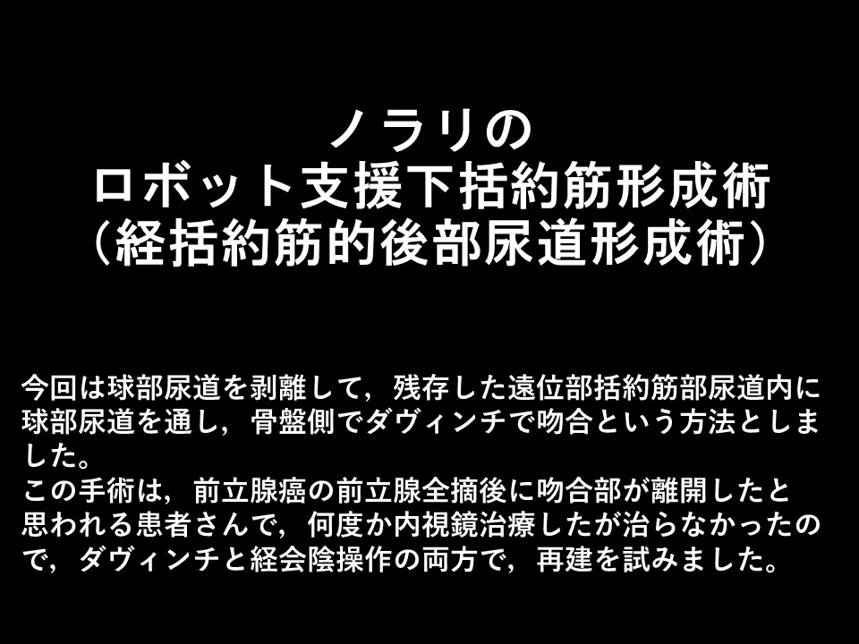 ロボット支援下経括約筋的後部尿道形成術の流れ01