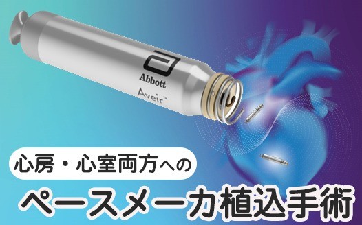 リードレスペースメーカによる心房･心室両方へのペースメーカ植込み手術を実施しました