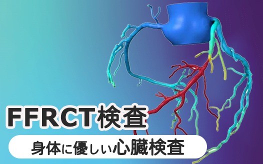 身体に優しい心臓検査「FFR-CT検査」を導入しました